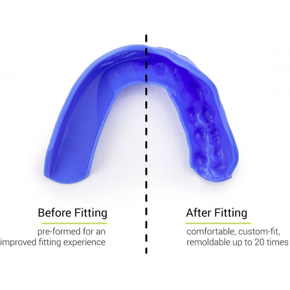 SISU 3D tandbeskytter – ultratynd 2,0 mm beskyttelse med præformet pasform og mulighed for omformning.